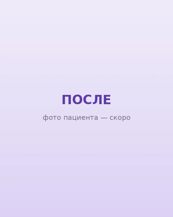 Лицо после контурной пластики — восстановлен объём и чёткий контур