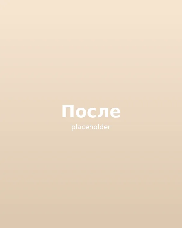 Оксана, 38 лет, мезотерапия коктейлем FILORGA NCTF — после курса