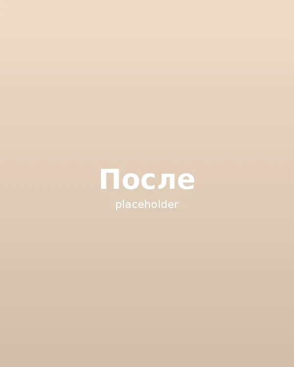 Татьяна, 43 года, мезотерапия коктейлем Meso-Wharton — после курса